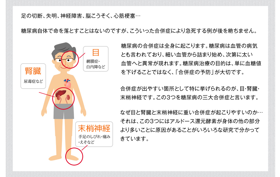 足の切断、失明、神経障害、脳こうそく、心筋梗塞…糖尿病自体で命を落とすことはないのですが、こういった合併症により急死する例が後を絶ちません。糖尿病の合併症は全身に起こります。糖尿病は血管の病気とも言われており、細い血管から詰まり始め、次第に太い血管へと異常が現れます。糖尿病治療の目的は、単に血糖値を下げることではなく、「合併症の予防」が大切です。合併症が出やすい箇所として特に挙げられるのが、目・腎臓・末梢神経です。この３つを糖尿病の三大合併症と言います。なぜ目と腎臓と末梢神経に重い合併症が起こりやすいのか…それは、この３つにはアルドース還元酵素が身体の他の部分より多いことに原因があることがいろいろな研究で分かってきています。アルドース還元酵素の働きを抑えることが可能になれば、合併症が起こりにくくなることが最近の研究で分かってきました。
